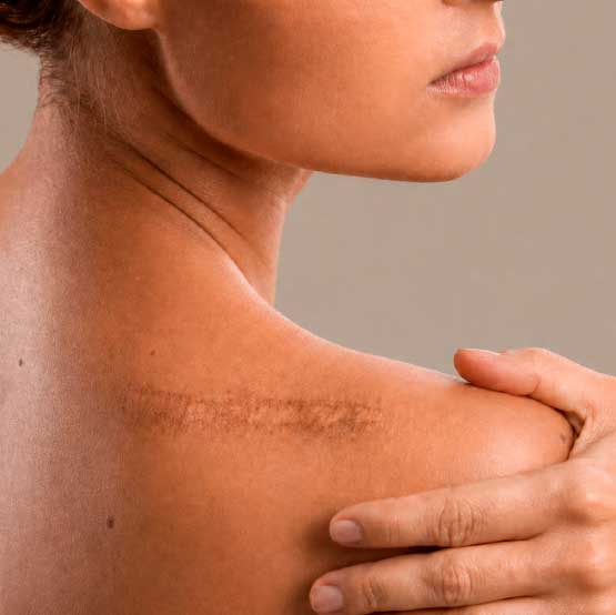 Resultado de dermopigmentación médica reconstructiva